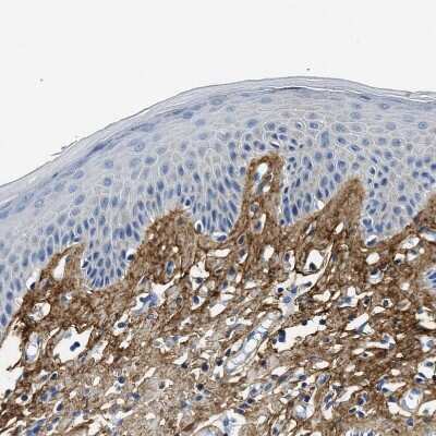 Immunohistochemistry-Paraffin: Beta Ig-h3/TGFBI Antibody [NBP2-48534]