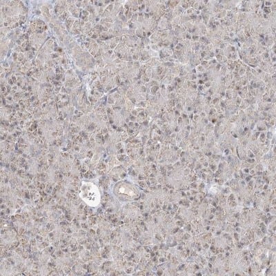Immunohistochemistry-Paraffin: LACTB Antibody [NBP1-91700]