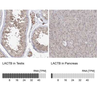 Immunohistochemistry-Paraffin: LACTB Antibody [NBP1-91700]