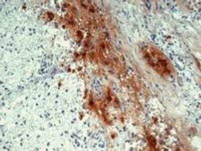 Immunohistochemistry: Beta-endorphin Antibody (B31.15) - BSA Free [NB500-414]