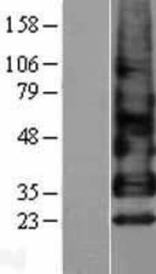 Western Blot: Betacellulin/BTC Overexpression Lysate [NBL1-08044]