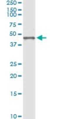 Immunoprecipitation: Biglycan Antibody (4E1-1G7) [H00000633-M01]