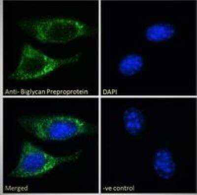 Immunocytochemistry/ Immunofluorescence: Biglycan Antibody [NB100-55407]