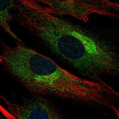 Immunocytochemistry/ Immunofluorescence: Biglycan Antibody [NBP1-84971]