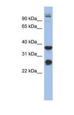 Western Blot: Biglycan Antibody [NBP1-57933]