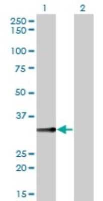 Western Blot: Biliverdin Reductase A/BLVRA Antibody (4G4-2B6) [H00000644-M01]