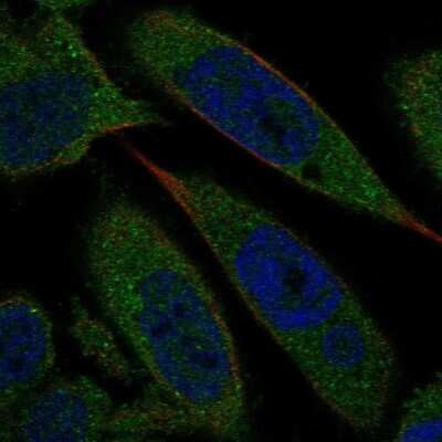Immunocytochemistry/ Immunofluorescence: Biliverdin Reductase A/BLVRA Antibody [NBP2-58063]