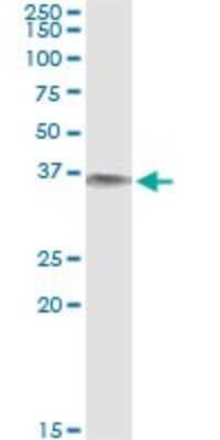 Immunoprecipitation: Biliverdin Reductase A/BLVRA Antibody (S2) [H00000644-M03]