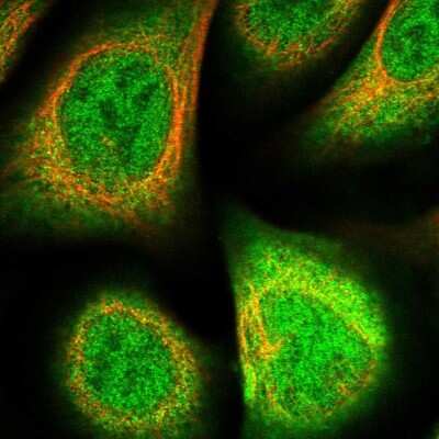Immunocytochemistry/ Immunofluorescence: Biliverdin Reductase B/BLVRB Antibody [NBP1-83435]