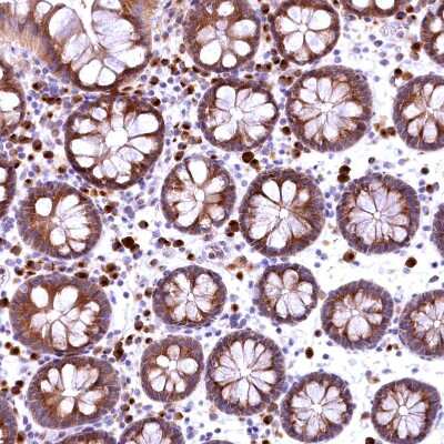 Immunohistochemistry-Paraffin: Biliverdin Reductase B/BLVRB Antibody [NBP1-83434]