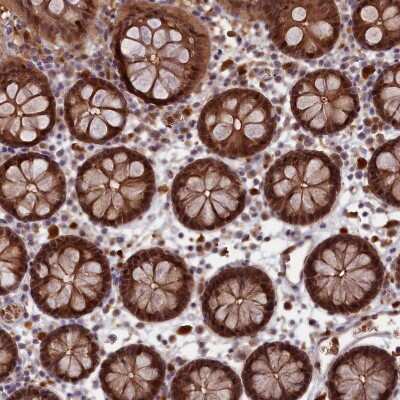 Immunohistochemistry-Paraffin: Biliverdin Reductase B/BLVRB Antibody [NBP1-83435]