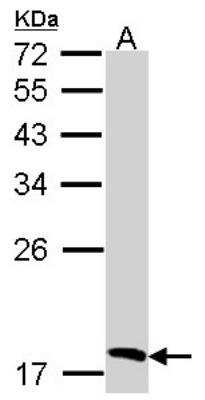 Western Blot: Biliverdin Reductase B/BLVRB Antibody [NBP1-31143]