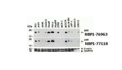 Western Blot: Bim AntibodyBSA Free [NBP1-77118]