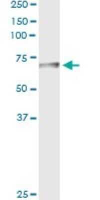 Immunoprecipitation: Biotinidase/BTD Antibody (3B10-2B3) [H00000686-M01]