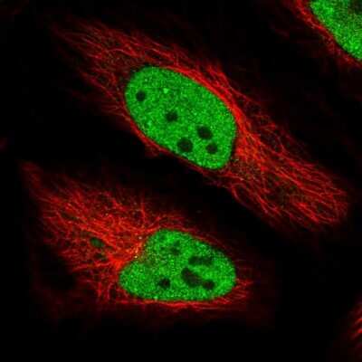 Immunocytochemistry/ Immunofluorescence: Bmf Antibody [NBP1-84660]