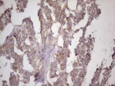 Immunohistochemistry: Bmf Antibody (OTI6F3) - Azide and BSA Free [NBP2-72311]