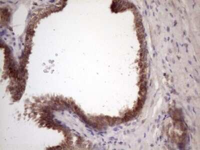Immunohistochemistry: Bmf Antibody (OTI6F3) - Azide and BSA Free [NBP2-72311]