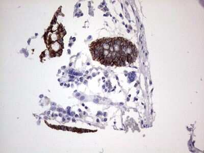 Immunohistochemistry: Boll Antibody (OTI2D11) [NBP2-46582]