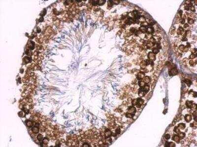 Immunohistochemistry-Paraffin: Boll Antibody [NBP2-15603]