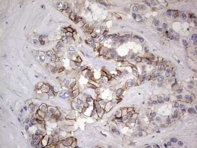 Immunohistochemistry: Boll Antibody (OTI2D11) - Azide and BSA Free [NBP2-72180]