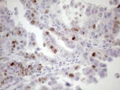 Immunohistochemistry: Borealin Antibody (OTI4G3) [NBP2-46199]