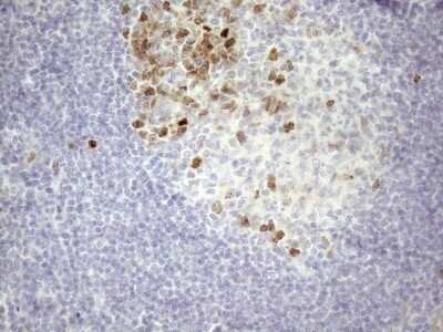 Immunohistochemistry: Borealin Antibody (OTI4G3) [NBP2-46199]