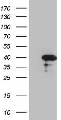 Western Blot: Borealin Antibody (OTI4G3) [NBP2-46199]