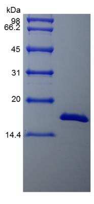 SDS-PAGE: Recombinant Bovine FGF basic/FGF2/bFGF Protein [NBP2-34877]