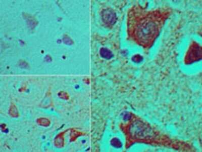 Immunohistochemistry-Paraffin: Brachyury Antibody [NBP2-24676]