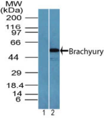 Western Blot: Brachyury Antibody [NBP2-24676]