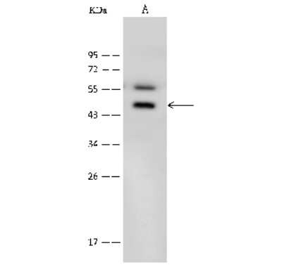 Western Blot: Bradykinin RB1/BDKRB1 Antibody [NBP2-99565]