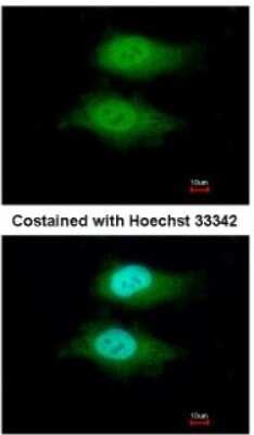 Immunocytochemistry/ Immunofluorescence: Breast cancer suppressor candidate 1 Antibody [NBP2-15615]