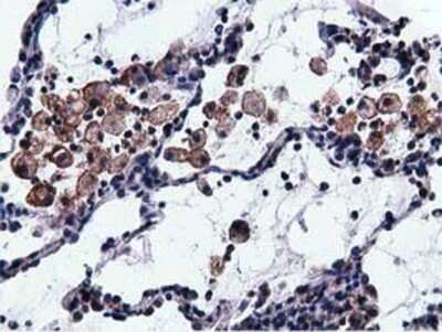 Immunohistochemistry: Breast cancer suppressor candidate 1 Antibody (OTI3D6) - Azide and BSA Free [NBP2-71158]