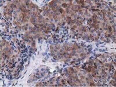 Immunohistochemistry-Paraffin: Breast cancer suppressor candidate 1 Antibody (OTI3D6) [NBP2-02898]