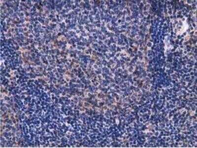 Immunohistochemistry-Paraffin: Breast cancer suppressor candidate 1 Antibody (OTI3D6) [NBP2-02898]
