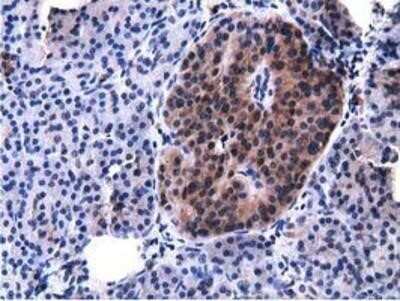 Immunohistochemistry-Paraffin: Breast cancer suppressor candidate 1 Antibody (OTI3D6) [NBP2-02898]