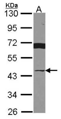 Western Blot: Breast cancer suppressor candidate 1 Antibody [NBP2-15615]