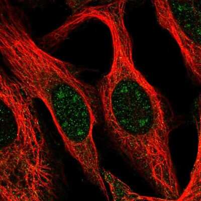 Immunocytochemistry/ Immunofluorescence: Breast carcinoma amplified sequence 3 Antibody [NBP2-58584]