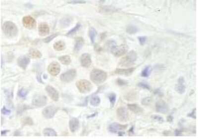 Immunohistochemistry-Paraffin: Breast carcinoma amplified sequence 3 Antibody [NB110-40682]