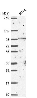 Western Blot: Breast carcinoma amplified sequence 3 Antibody [NBP2-58584]