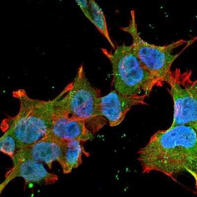 Immunocytochemistry/ Immunofluorescence: Brevican Antibody (S294A-6) [NBP2-22401]
