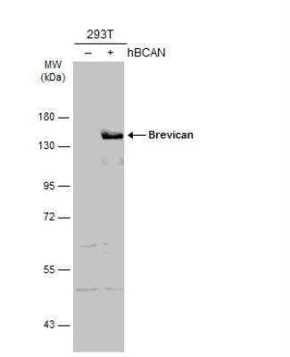 Western Blot: Brevican Antibody [NBP2-15616]