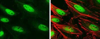 Immunocytochemistry/ Immunofluorescence: Brg1 Antibody (GT2712) [NBP3-13537]