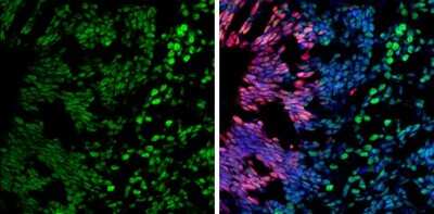 Immunohistochemistry-Frozen: Brg1 Antibody (GT2712) [NBP3-13537]