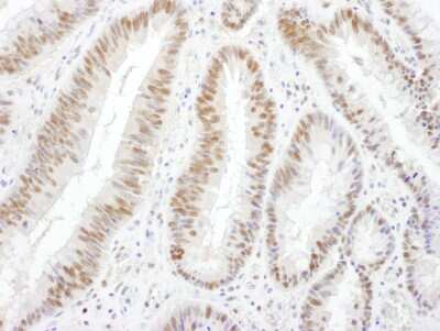 Immunohistochemistry: Brg1 Antibody [NBP2-22234]