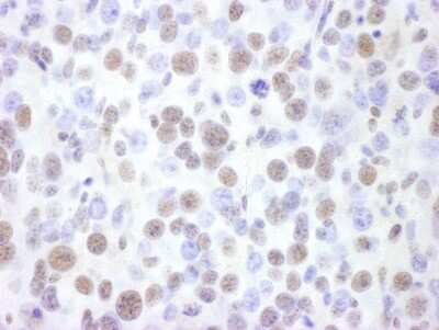Immunohistochemistry: Brg1 Antibody [NBP2-22234]