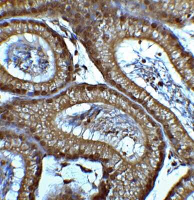 Immunohistochemistry-Paraffin: Brg1 Antibody - BSA Free [NBP2-41270]