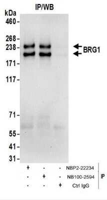 Immunoprecipitation: Brg1 Antibody [NBP2-22234]
