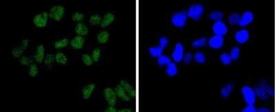 Immunocytochemistry/ Immunofluorescence: Brg1 Antibody (SN20-03) [NBP2-74964]