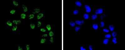Immunocytochemistry/ Immunofluorescence: Brg1 Antibody (SN20-03) [NBP2-74964]